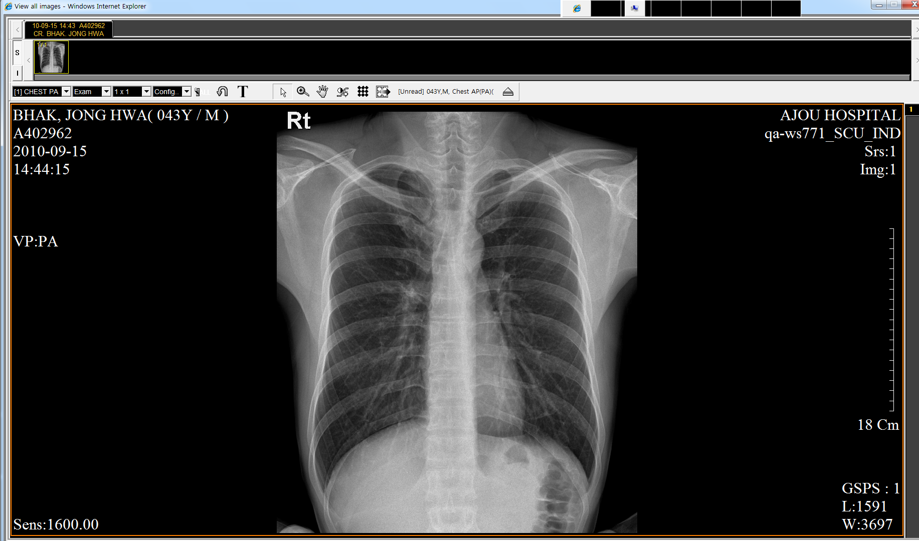 Chest_image_captured_JongBhak_20100915.png