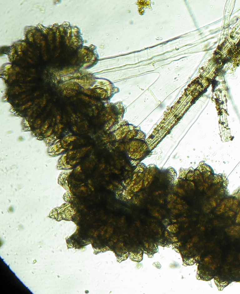 Opercularia_ampluscolonia1.jpg