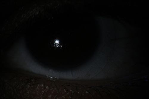 Contact_Lens_4023.jpg