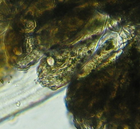 Opercularia_ampluscolonia_close_up.jpg